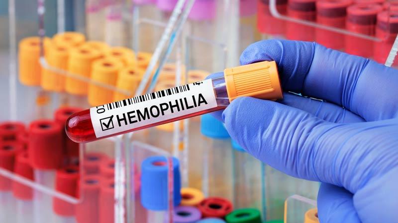 Hemofilia