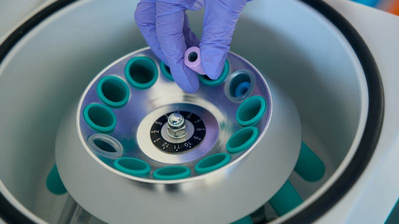 Prueba-prequirurjica